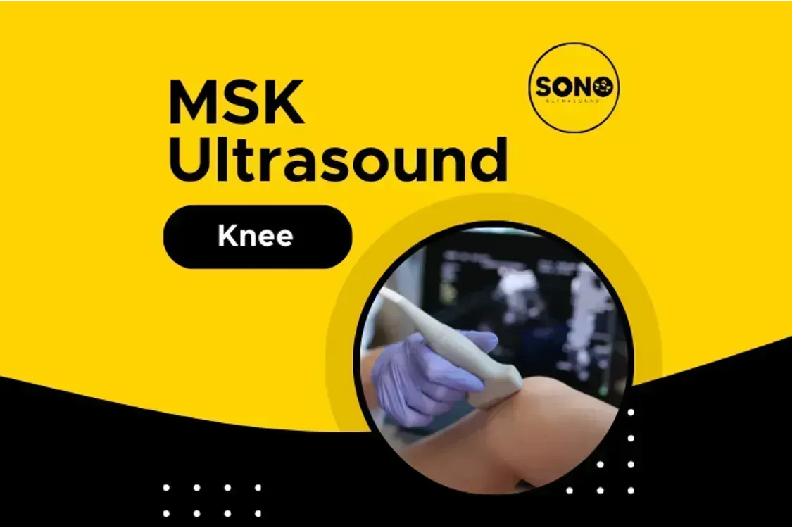 MSK Scan: Knee Malaysia